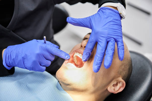 Best Emergency Treatment for Dental Infections or Abscesses in Springdale, SC